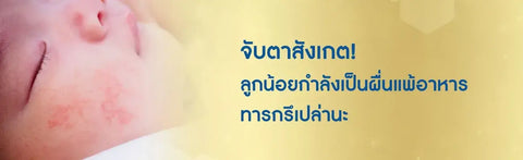 จับตาสังเกต! ลูกน้อยกำลังเป็นผื่นแพ้อาหารทารกรึเปล่านะ